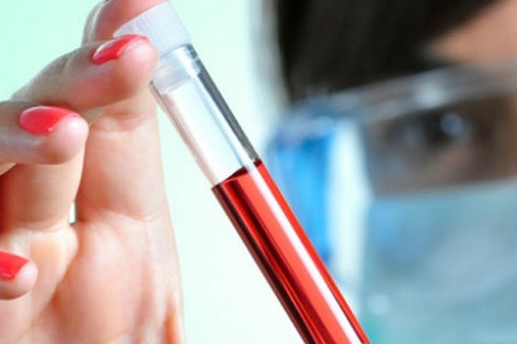 Evropljani malo znaju o hepatitisu i malim boginjama