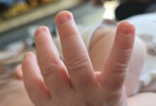Zvorničko porodilište: U julu rođene 42 bebe