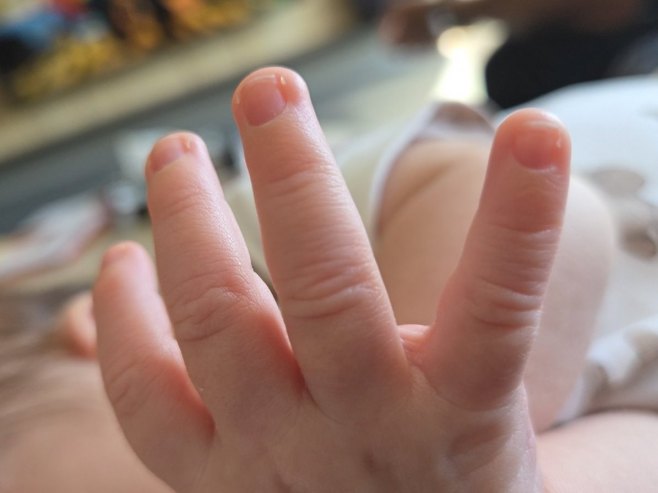 Zvorničko porodilište: U julu rođene 42 bebe
