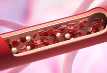 Naučnici otkrili mikroplastiku u ljudskim arterijama