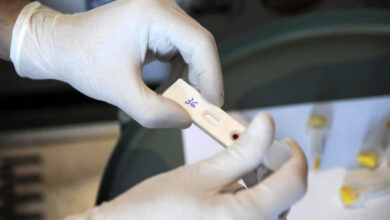Epidemija HIV-a na Fidžiju: Zbog širenja zaraze proglašena nacionalna kriza