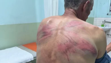Nenad Rašković brutalno pretučen, a policajci vraćeni na posao u Sjevernoj Mitrovici