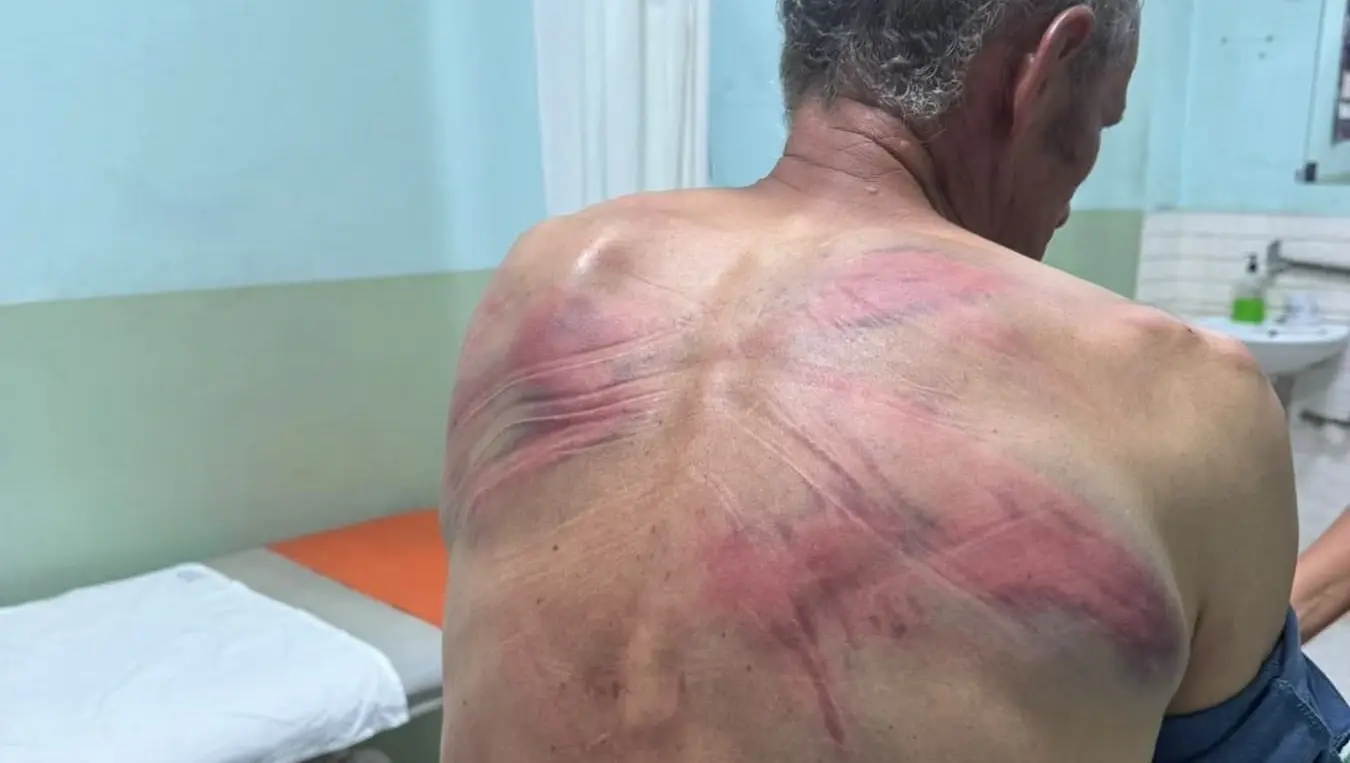 Nenad Rašković brutalno pretučen, a policajci vraćeni na posao u Sjevernoj Mitrovici