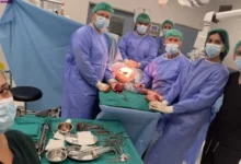 U UKC-u RS uklonjen veliki tumor iz pazušne regije