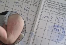 Dječak u Banjaluci primio Pentaxim umjesto vakcine protiv hepatitisa B, tri dana kasnije urtikarija