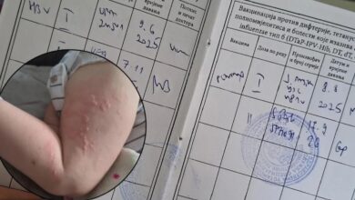 Dječak u Banjaluci primio Pentaxim umjesto vakcine protiv hepatitisa B, tri dana kasnije urtikarija